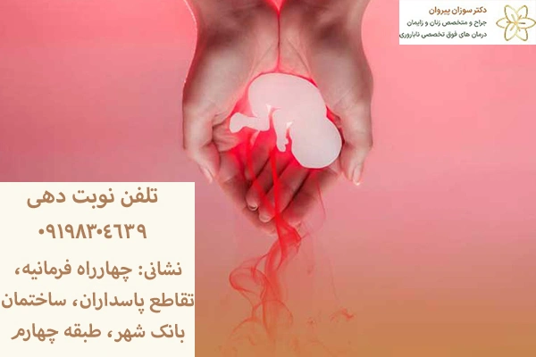 سقط خود به خودی جنین