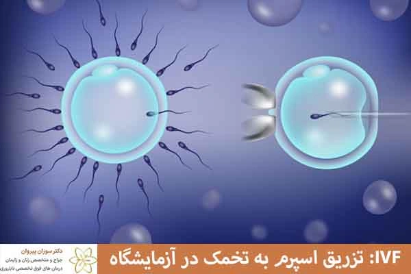 آی وی اف برای ناباروری مردان