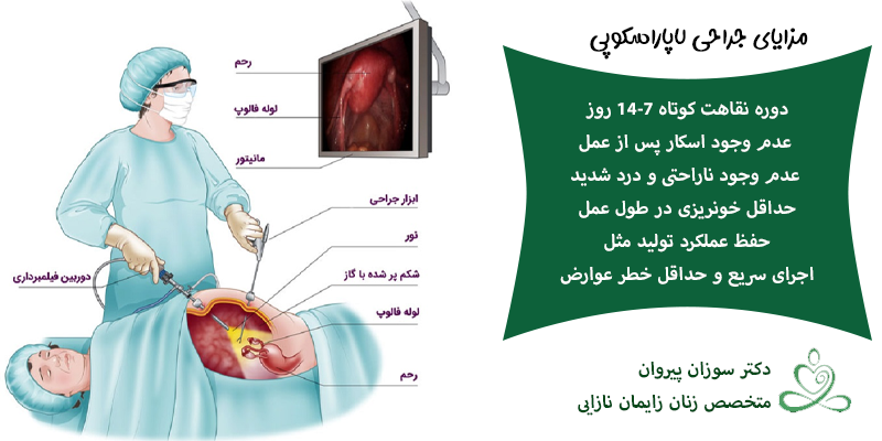 مزایا جراحی لاپاراسکوپی