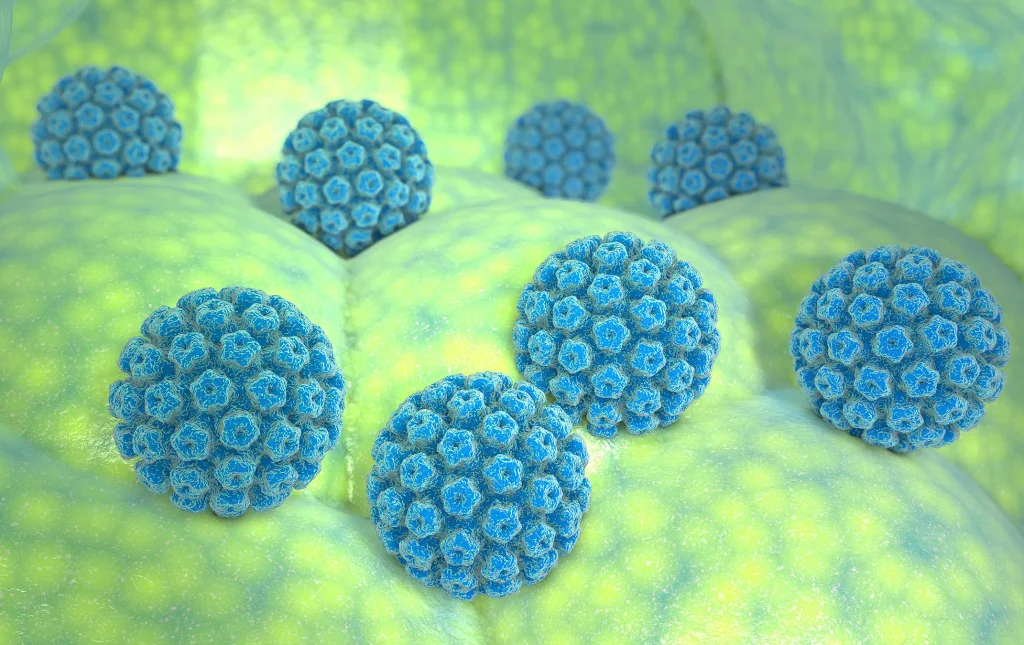 زگیل تناسلی