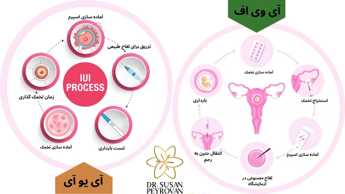 تفاوت آی یو آی و آی وی اف