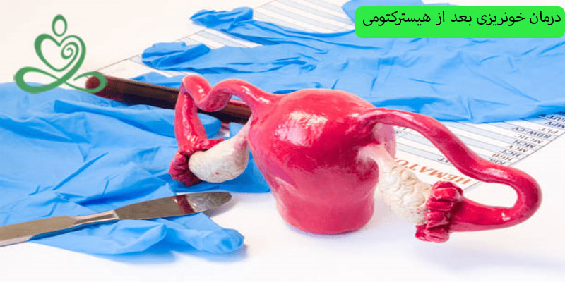 درمان-خونریزی-بعد-از-هیسترکتومی