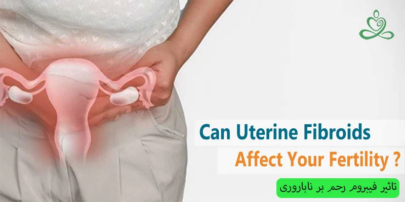 تاثیر-فیبروم-رحم-در-ناباروری