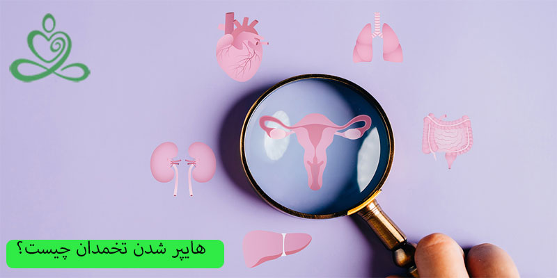 هایپر-شدن-تخمدان