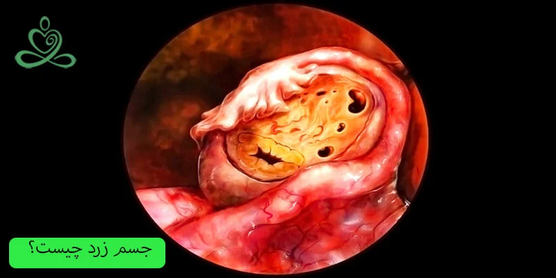 جسم-زرد-چیست؟