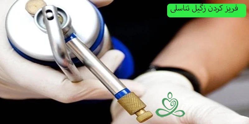 فریز-کردن-زگیل-تناسلی