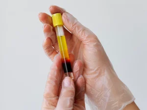 پی آر پی رحم