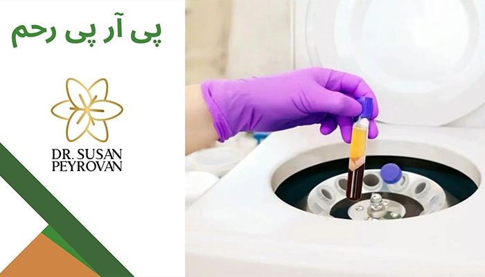 پی آر پی رحم