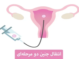 انتقال جنین دو مرحلهای