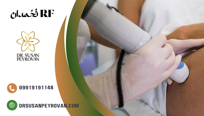 آر اف تخمدان