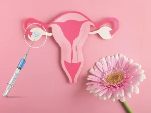 پی آر پی تخمدان